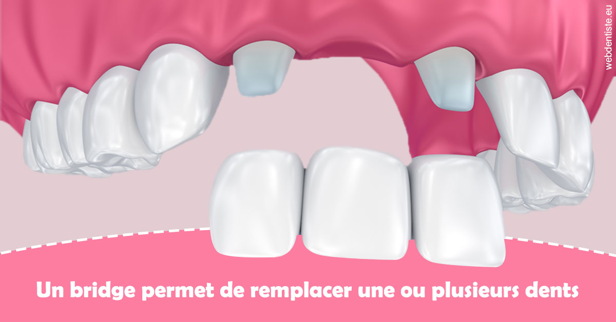 https://damiani-richelme.test.moncomptewebdentiste.fr/Bridge remplacer dents 2