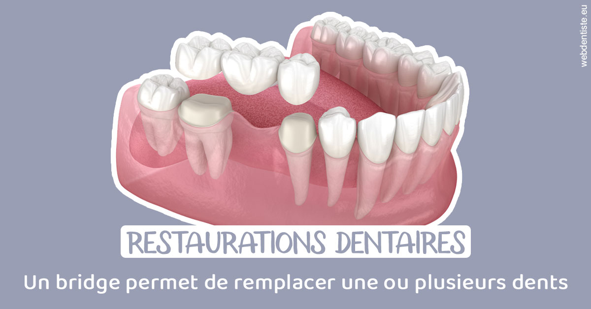 https://damiani-richelme.test.moncomptewebdentiste.fr/Bridge remplacer dents 1