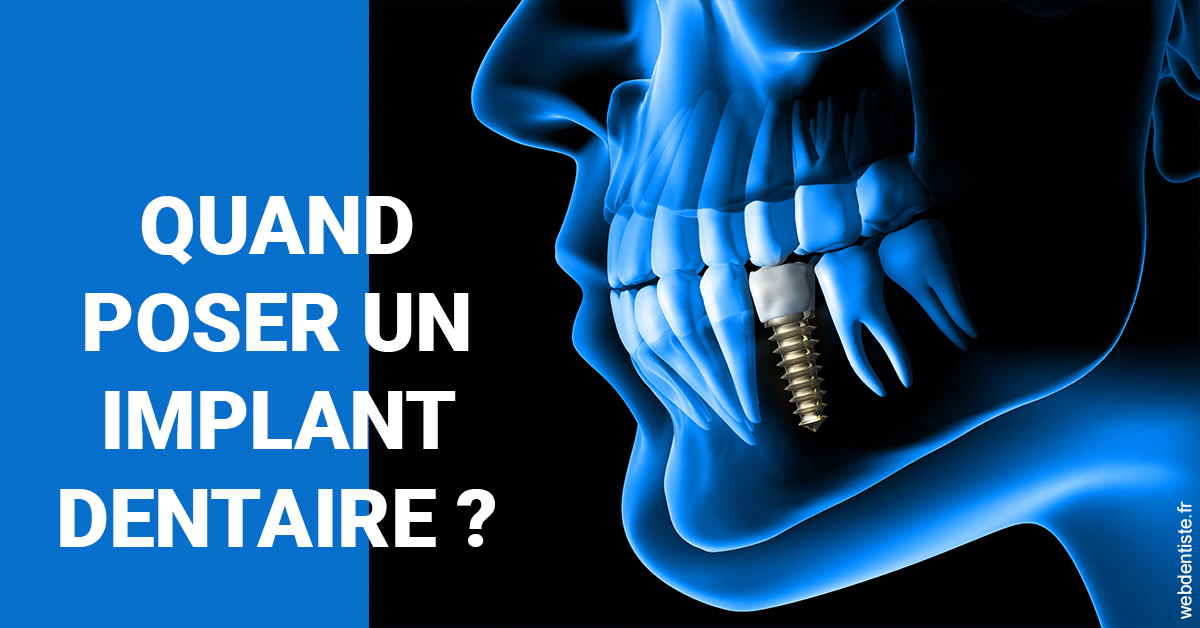 https://damiani-richelme.test.moncomptewebdentiste.fr/Les implants 1