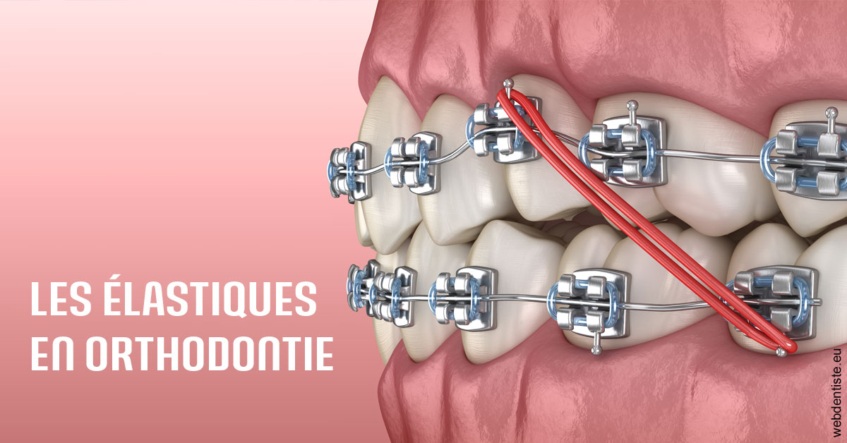 https://damiani-richelme.test.moncomptewebdentiste.fr/Elastiques orthodontie 2