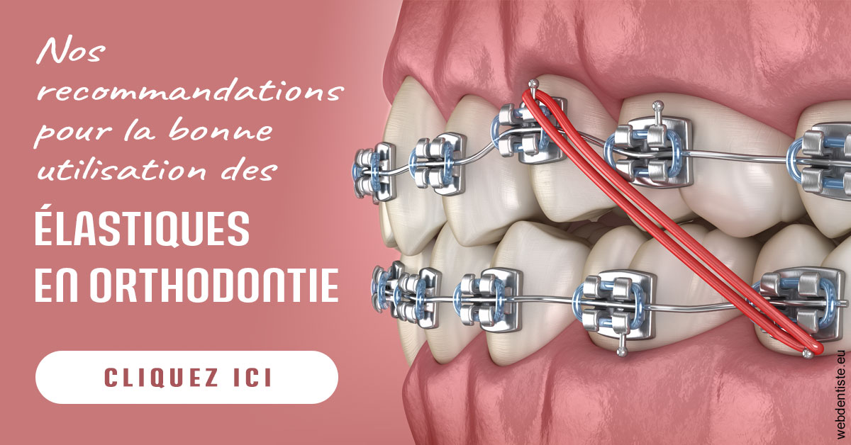 https://damiani-richelme.test.moncomptewebdentiste.fr/Elastiques orthodontie 2